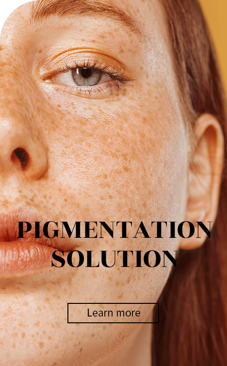 Best pigmentation treatments in Seoul