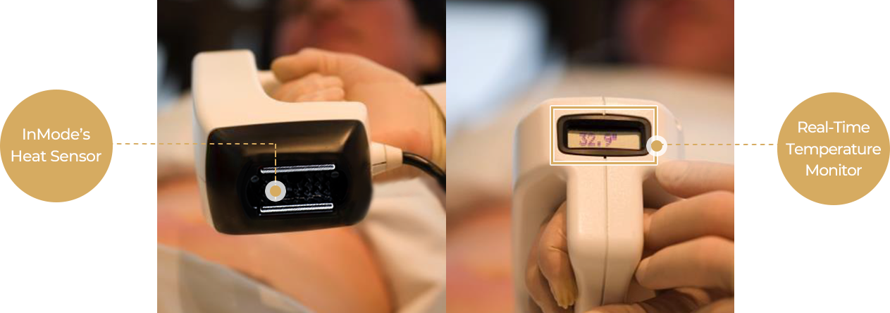 InMode FX fat reducing laser lifting treatment in Seoul