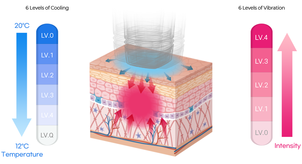 Best Volnewmer lifting laser treatment in Seoul