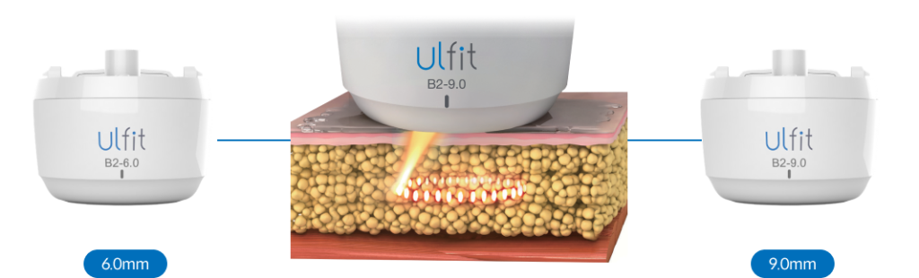 Ulfit body lifting laser, best anti-aging treatment to tighten sagging skin