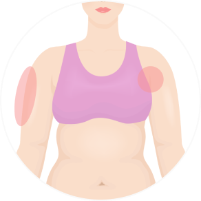 Ulfit body lifting laser, safe and non-invasive fat loss treatment in Seoul