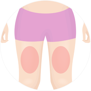 Ulfit, best diet treatment with no liposuction