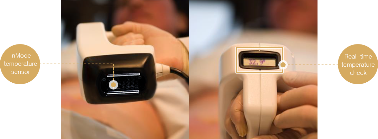 InMode FX laser lifting, diet, fat loss, weight loss treatment in Seoul