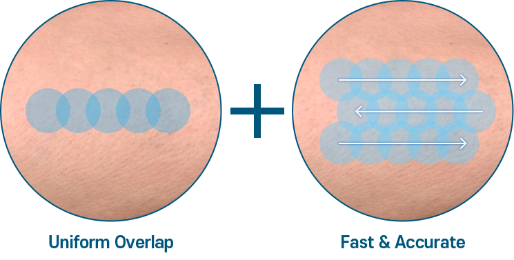 Clarity 2 II acne laser, best dermatology in Seoul