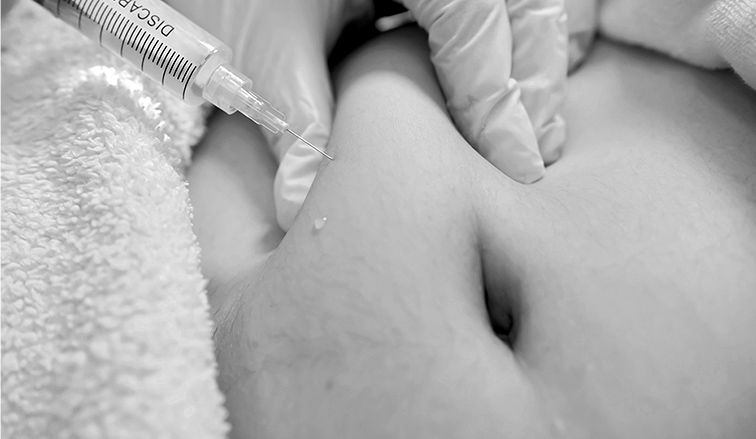 Best fat loss treatments in Seoul for foreigners