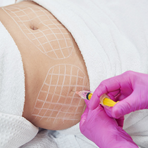 Safe and effective fat dissolving injections in Seoul for foreigners