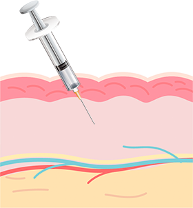 Best beauty clinic in Seoul for filler