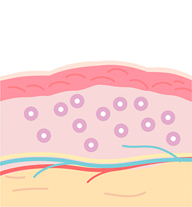 Best dermatology clinic in Seoul for filler treatments