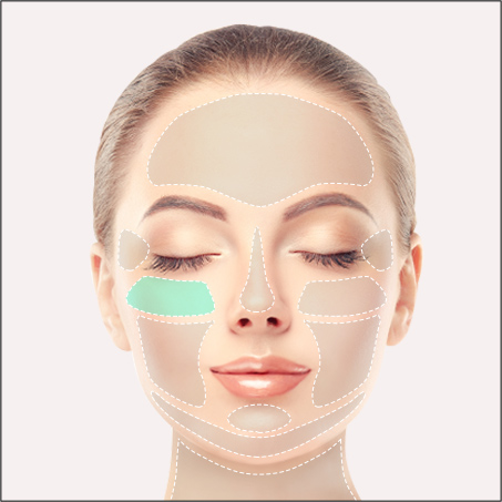 Best foreigner friendly skin texture and acne scar treatment in Seoul, Potenza microneedling