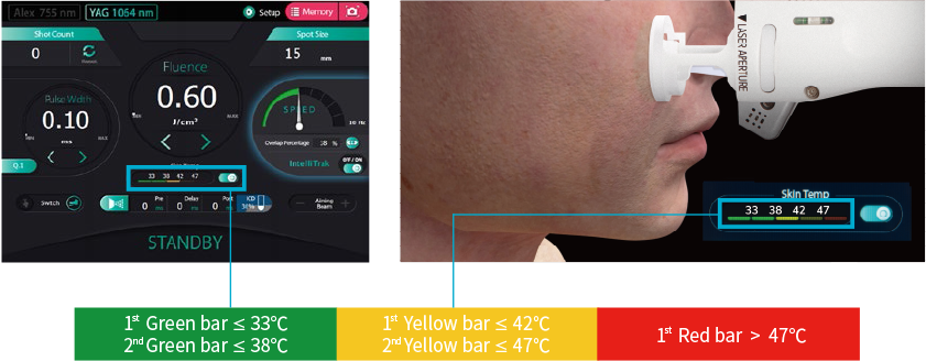 Clarity 2 II acne laser treatment, safe and effective skincare for foreigners in Seoul