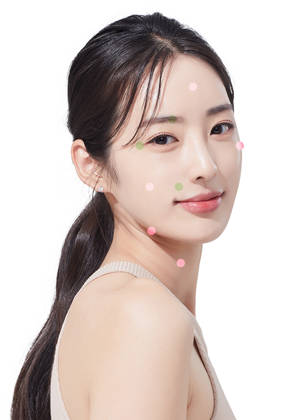 Volnewmer laser lifting treatment - the best anti-aging treatment for foreigners in Seoul