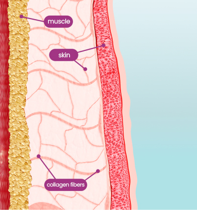 Thermage FLX, anti-aging skin treatment for foreigners