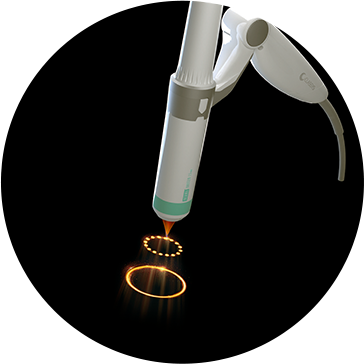 Affordable Shurink Universe laser lifting treatment in Seoul - English friendly dermatology clinic in Gangnam, Myeongdong, Hongdae